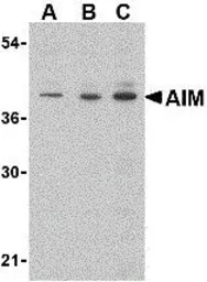 Anti-CD5L antibody, C-term used in Western Blot (WB). GTX41904