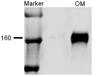 Anti-NKCC2 antibody used in Western Blot (WB). GTX41968