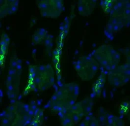 Anti-NCC antibody used in Immunocytochemistry/ Immunofluorescence (ICC/IF). GTX41969