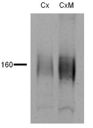 Anti-NCC antibody used in Western Blot (WB). GTX41969