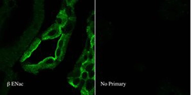 Anti-ENaC Beta antibody used in Immunocytochemistry/ Immunofluorescence (ICC/IF). GTX41971