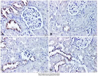Anti-ENaC Beta antibody used in IHC (Paraffin sections) (IHC-P). GTX41971