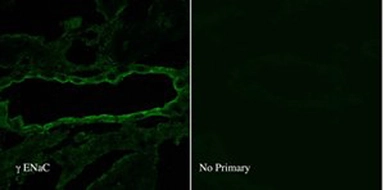 Anti-ENaC Gamma antibody used in Immunocytochemistry/ Immunofluorescence (ICC/IF). GTX41972