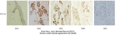 Anti-UT-A1 antibody used in IHC (Paraffin sections) (IHC-P). GTX41973