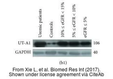 Anti-UT-A1 antibody used in Western Blot (WB). GTX41973