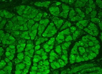 Anti-CaMKII alpha antibody [22B1] used in IHC (Paraffin sections) (IHC-P). GTX41977