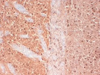 Anti-Cav3.2 antibody [S55-10] used in IHC (Frozen sections) (IHC-Fr). GTX41984
