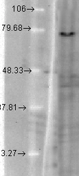 Anti-KCNQ1 antibody [S37A-10] used in Western Blot (WB). GTX41988