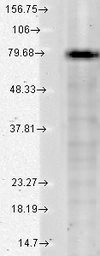 Anti-KCNQ1 antibody [S37A-10] used in Western Blot (WB). GTX41988