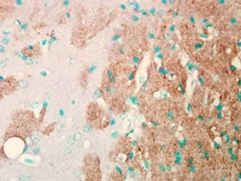 Anti-Nav1.7 antibody [S68-6] used in Immunohistochemistry (IHC). GTX41995