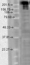 Anti-Nav1.7 antibody [S68-6] used in Western Blot (WB). GTX41995