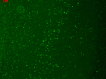 Anti-TRPM7 antibody [S74-25] used in Immunohistochemistry (IHC). GTX41997