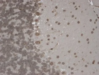 Anti-TRPM7 antibody [S74-25] used in Immunohistochemistry (IHC). GTX41997