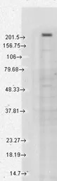 Anti-TRPM7 antibody [S74-25] used in Western Blot (WB). GTX41997