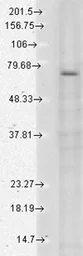 Anti-TRPV3 antibody [S15-4] used in Western Blot (WB). GTX42000