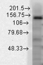 Anti-KCNT1 antibody [S3-26] used in Western Blot (WB). GTX42002