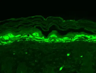 Anti-SHANK1 antibody [S22-21] used in IHC (Paraffin sections) (IHC-P). GTX42008
