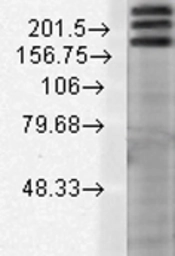 Anti-SHANK1 antibody [S22-21] used in Western Blot (WB). GTX42008