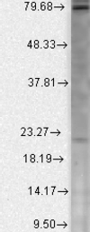 Anti-Cav beta 2 antibody [S8B-1] used in Western Blot (WB). GTX42011