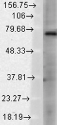 Anti-TRPV3 antibody [S15-39] used in Western Blot (WB). GTX42013
