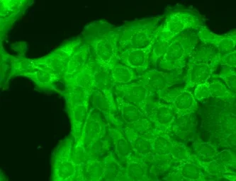 Anti-Nav1.8 antibody [S134-12] used in Immunocytochemistry/ Immunofluorescence (ICC/IF). GTX42021