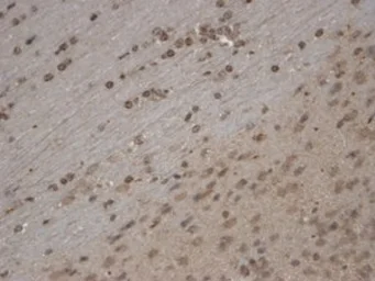 Anti-TrpC5 antibody [S67-15] used in Immunohistochemistry (IHC). GTX42023