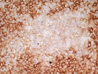 Anti-CD36 antibody [SM&#216;] used in IHC (Frozen sections) (IHC-Fr). GTX42050