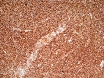 Anti-CD36 antibody [SM&#216;] used in IHC (Frozen sections) (IHC-Fr). GTX42050