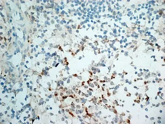 Anti-NKG2D antibody [1D11] used in IHC (Frozen sections) (IHC-Fr). GTX42086