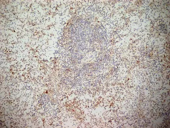 Anti-NKG2D antibody [1D11] used in IHC (Frozen sections) (IHC-Fr). GTX42086