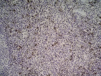 Anti-NKG2D antibody [1D11] used in IHC (Frozen sections) (IHC-Fr). GTX42086