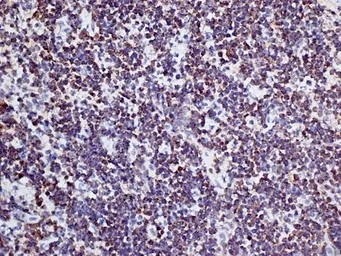 Anti-CD3 antibody [KT3] used in IHC (Frozen sections) (IHC-Fr). GTX42104