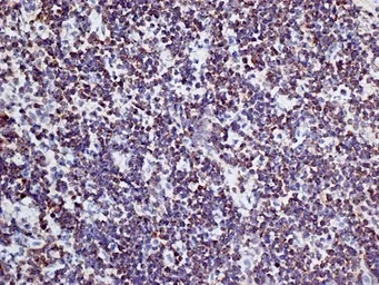 Anti-CD3 antibody [KT3] used in IHC (Frozen sections) (IHC-Fr). GTX42105