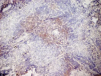 Anti-CD3 antibody [KT3] used in IHC (Frozen sections) (IHC-Fr). GTX42105