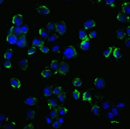 Anti-p75 NGF Receptor / CD271 antibody used in Immunocytochemistry/ Immunofluorescence (ICC/IF). GTX42173