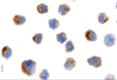 Anti-p75 NGF Receptor / CD271 antibody used in Immunocytochemistry/ Immunofluorescence (ICC/IF). GTX42173