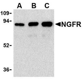 Anti-p75 NGF Receptor / CD271 antibody used in Western Blot (WB). GTX42173