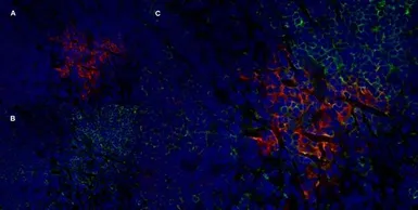 Anti-IL2 Receptor alpha antibody [OX-39] used in IHC (Frozen sections) (IHC-Fr). GTX42210