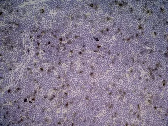 Anti-IL2 Receptor alpha antibody [OX-39] used in IHC (Frozen sections) (IHC-Fr). GTX42210
