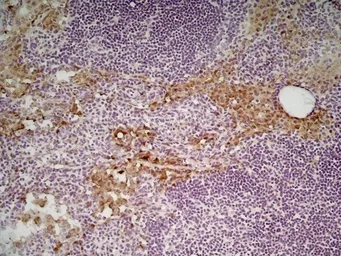 Anti-Mannose Receptor antibody [MR5D3] used in IHC (Frozen sections) (IHC-Fr). GTX42263