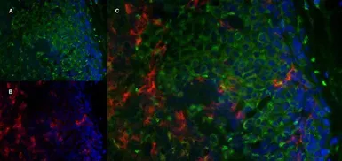 Anti-Mannose Receptor antibody [MR5D3] used in IHC (Frozen sections) (IHC-Fr). GTX42264