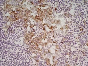 Anti-Mannose Receptor antibody [MR5D3] used in IHC (Frozen sections) (IHC-Fr). GTX42264