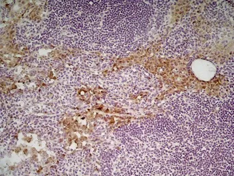 Anti-Mannose Receptor antibody [MR5D3] used in IHC (Frozen sections) (IHC-Fr). GTX42264