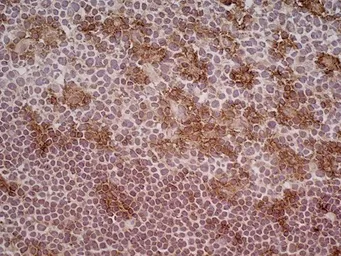 Anti-CD205 antibody [MG38] (Low endotoxin, azide free) used in IHC (Frozen sections) (IHC-Fr). GTX42273
