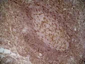 Anti-CD205 antibody [MG38] (Low endotoxin, azide free) used in IHC (Frozen sections) (IHC-Fr). GTX42273