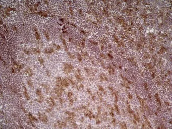Anti-CD205 antibody [MG38] (Low endotoxin, azide free) used in IHC (Frozen sections) (IHC-Fr). GTX42273