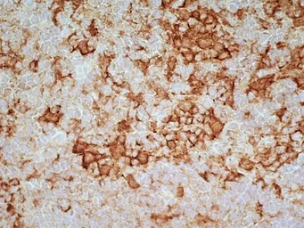 Anti-CD169 antibody [ED3] used in IHC (Frozen sections) (IHC-Fr). GTX42356