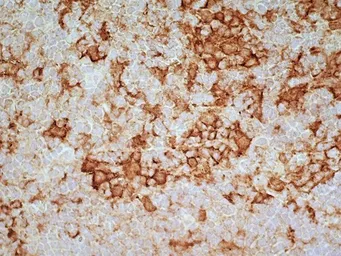Anti-CD169 antibody [ED3] used in IHC (Frozen sections) (IHC-Fr). GTX42357