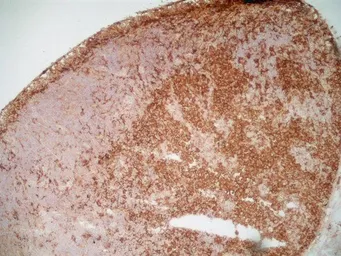 Anti-CD169 antibody [ED3] used in IHC (Frozen sections) (IHC-Fr). GTX42357