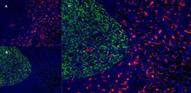 Anti-CD163 antibody [EDHu-1] used in IHC (Frozen sections) (IHC-Fr). GTX42364